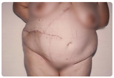 M�t�t ut�ni �llapot.