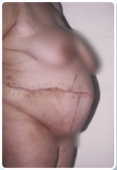 M�t�t ut�ni �llapot.