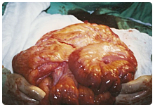 M�t�t k�zben. A s�rv t�ml�ben l�v� v�konyb�l.