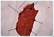 M�t�t k�zben. S�rvkap� z�r�s h�l� fed�s�vel.